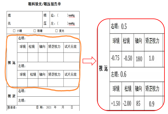 最新眼压标准及其应用解析